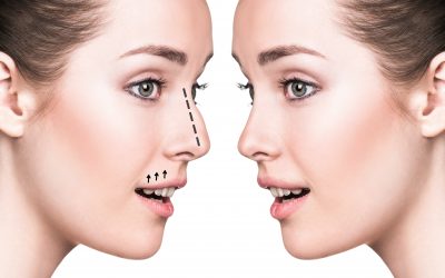 Plastic Surgeon in Prescot