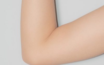 Arm Lift Surgery Liverpool