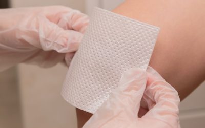 Skin Cancer Examination Liverpool